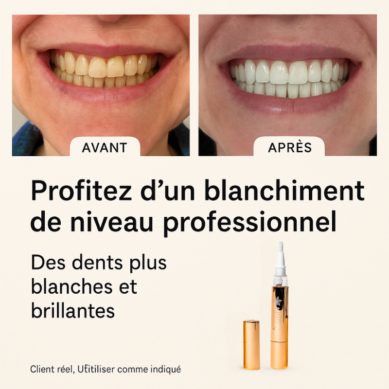 MUMOVA™ – Stylo Blanchissant Express